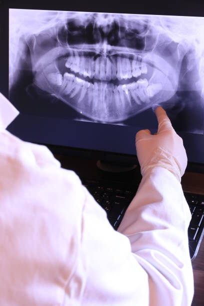 Best Emergency Tooth Extraction in Mathis, TX
