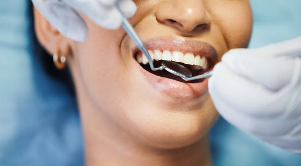Best Emergency Treatment for Dental Infections or Abscesses in Mathis, TX