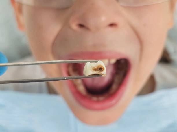 Best Pediatric Emergency Dentist in Mathis, TX