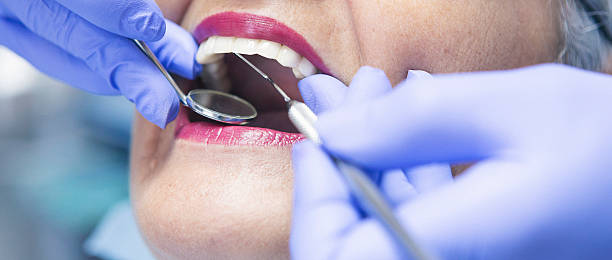 Best Emergency Dental Care for Broken or Chipped Teeth in Mathis, TX
